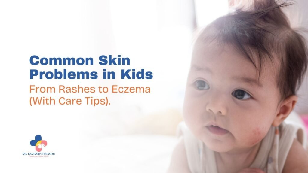 Common Skin Problems in Kids — From Rashes to Eczema (With Care Tips)